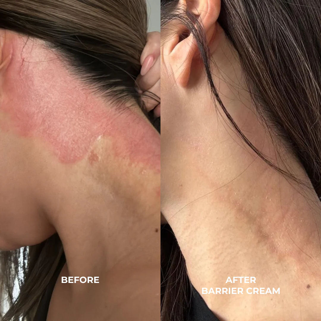 Barrier Cream-Moisturizers + Creams-VO Beauty-rev skin and wellness best facial in denver colorado acne expert