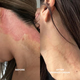 Barrier Cream-Moisturizers + Creams-VO Beauty-rev skin and wellness best facial in denver colorado acne expert
