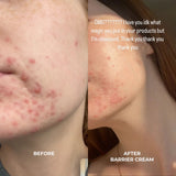 Barrier Cream-Moisturizers + Creams-VO Beauty-rev skin and wellness best facial in denver colorado acne expert
