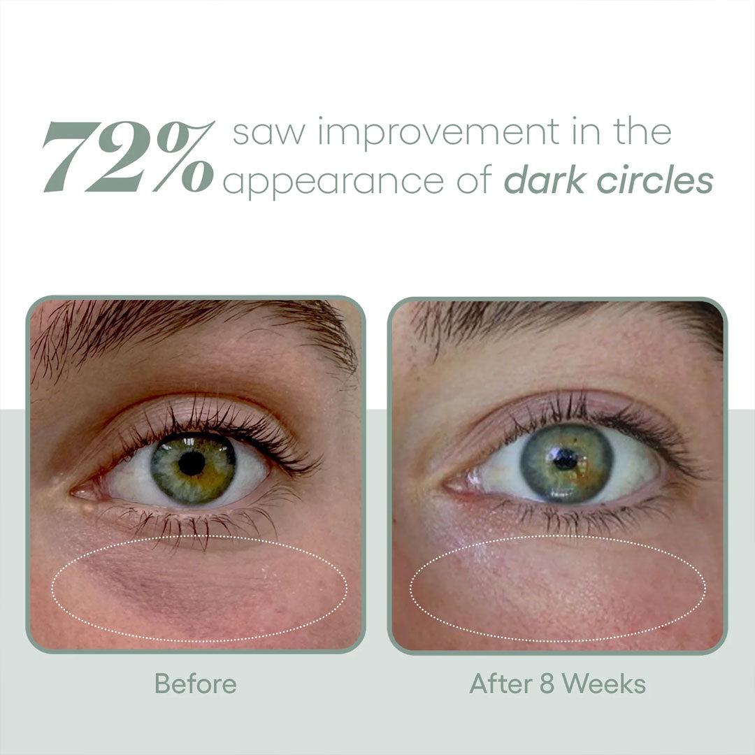 EYE Serum-Eye Care-Plated-rev skin and wellness best facial in denver colorado acne expert