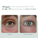 EYE Serum-Eye Care-Plated-rev skin and wellness best facial in denver colorado acne expert