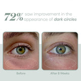 EYE Serum-Eye Care-Plated-rev skin and wellness best facial in denver colorado acne expert